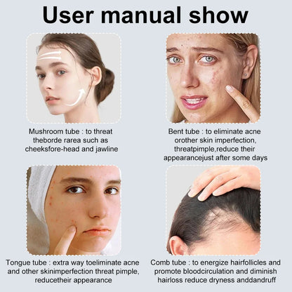 Darsonval High Frequency Facial Machine – 6-in-1 | Anti-Acne, Wrinkle Reduction & Skin Rejuvenation